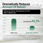 Anua Heartleaf 77 Clear Pad 160Ml - Image 4